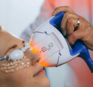 Dry Eye Syndrome